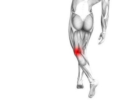 Artrosis de la articulación de la rodilla
