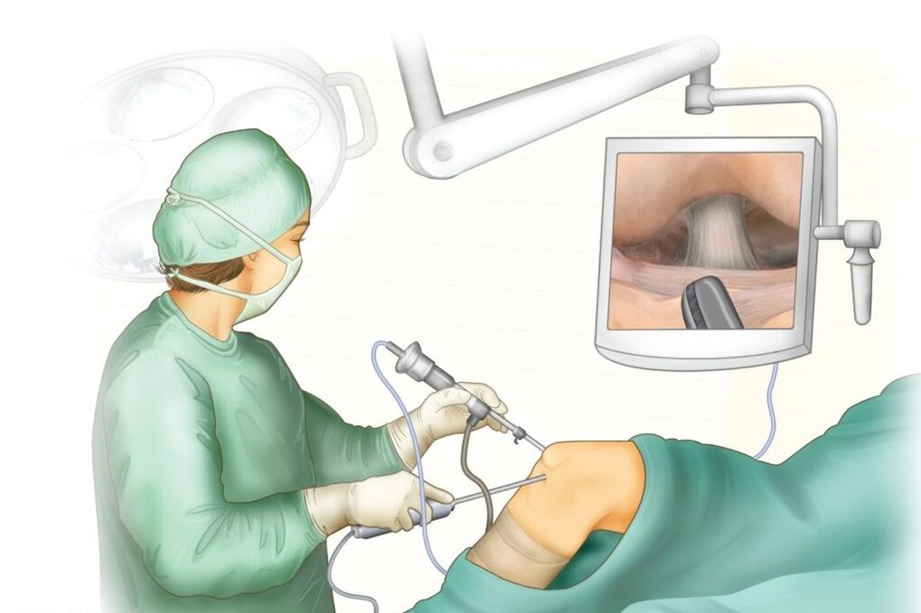Cirugía de articulación de la rodilla