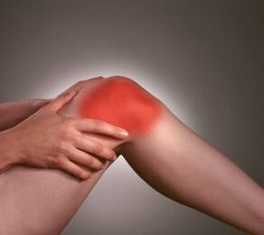 Síntomas de artrosis de la articulación de la rodilla