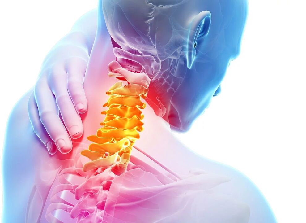 Osteocondrosis cervical