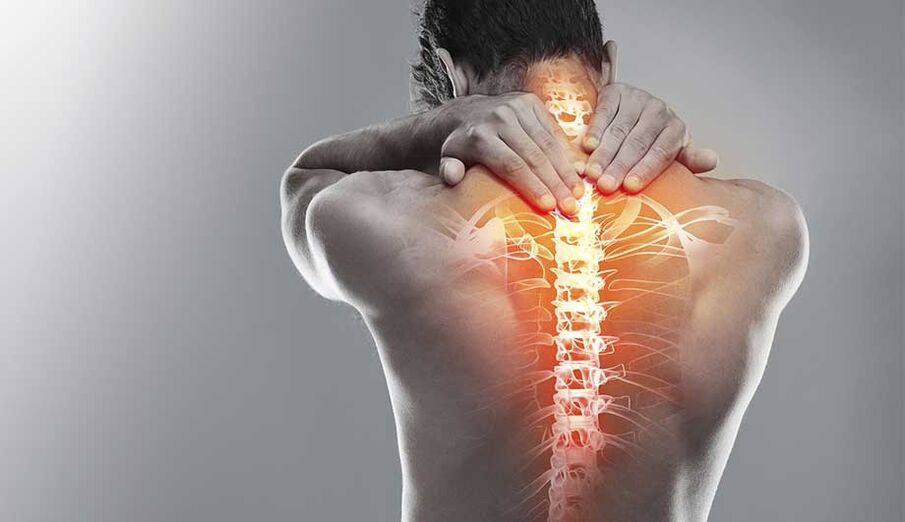 Dolor en la columna debido a la osteocondrosis.
