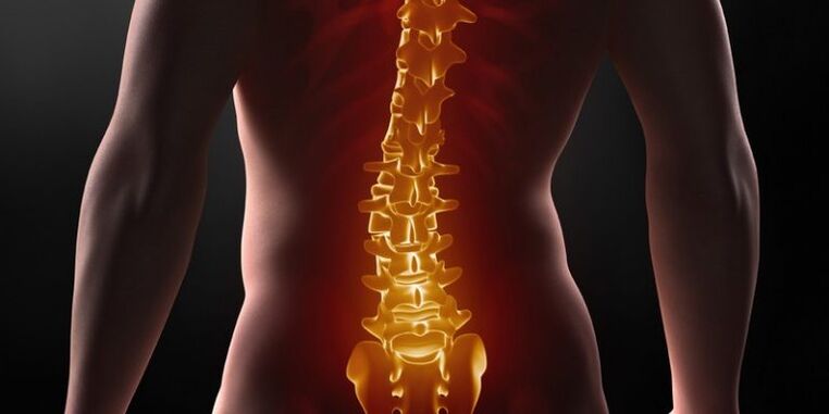 Osteocondrosis de la columna sacra.