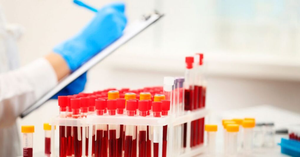 Realizar un análisis de sangre para detectar inflamación.