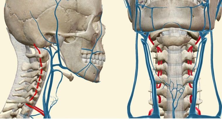 Síndrome vascular en osteocondrosis.